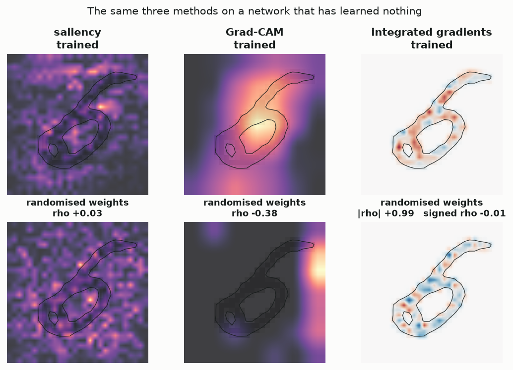 A two-by-three grid. The top row shows saliency, Grad-CAM and integrated gradients from the trained network; the bottom row shows the same three from a randomly initialised network. The integrated-gradients pair look nearly identical in magnitude.