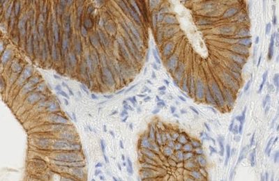 Glándulas del colon teñidas por inmunohistoquímica; la señal marrón de DAB marca la expresión de FHL2 sobre un contraste azul de hematoxilina.