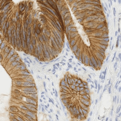 Imagen en color de tejido teñido por inmunohistoquímica de scikit-image, un ejemplo de imagen de microscopía cuyos canales de color están ordenados según el hardware de captura.